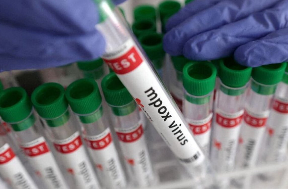 Representative Image - Reuters